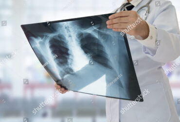 Röntgen vizsgálat