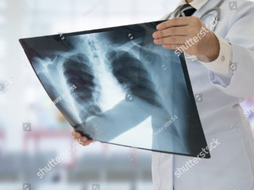 Röntgen vizsgálat